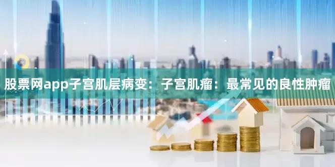 股票网app子宫肌层病变:子宫肌瘤:最常见的良性肿瘤